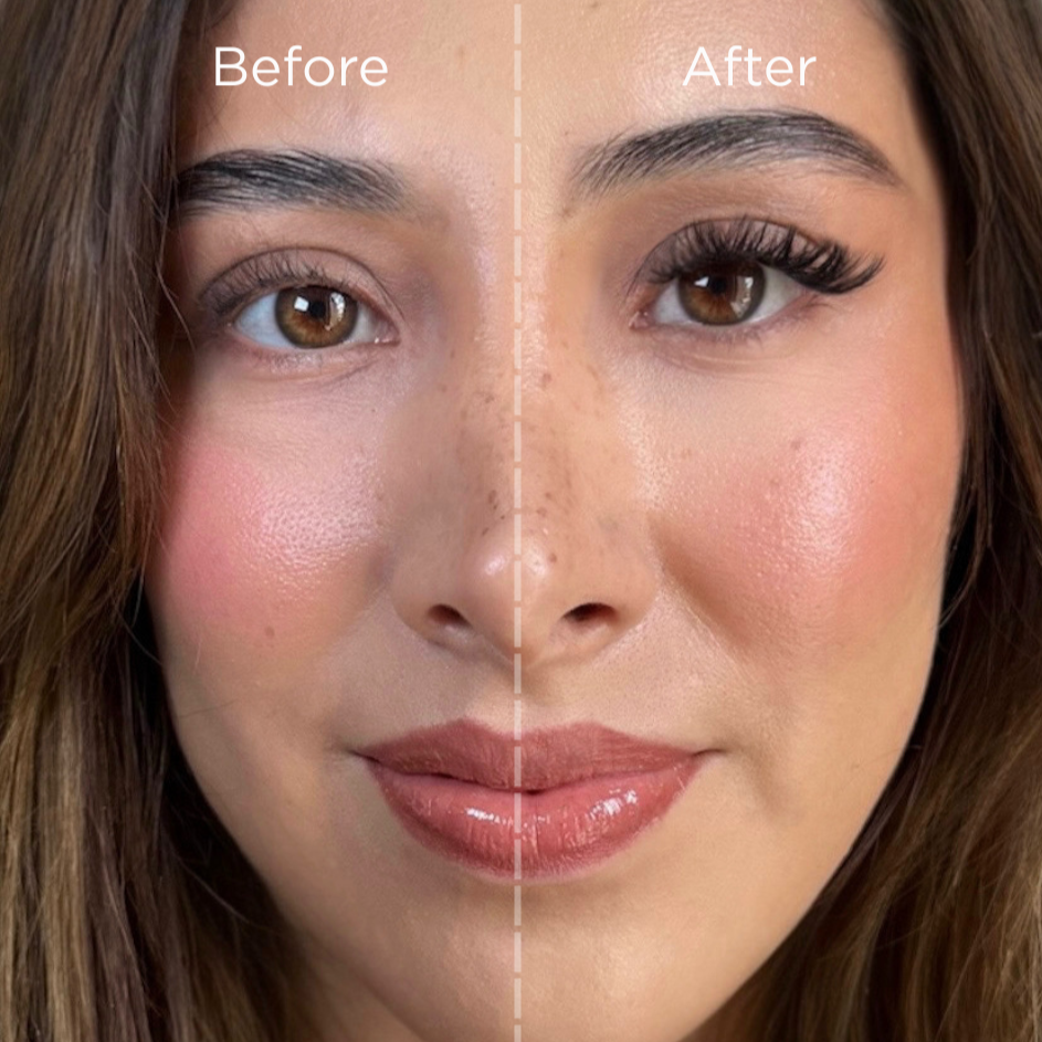 Before and after comparison of a woman's face with a visible line separating the two.